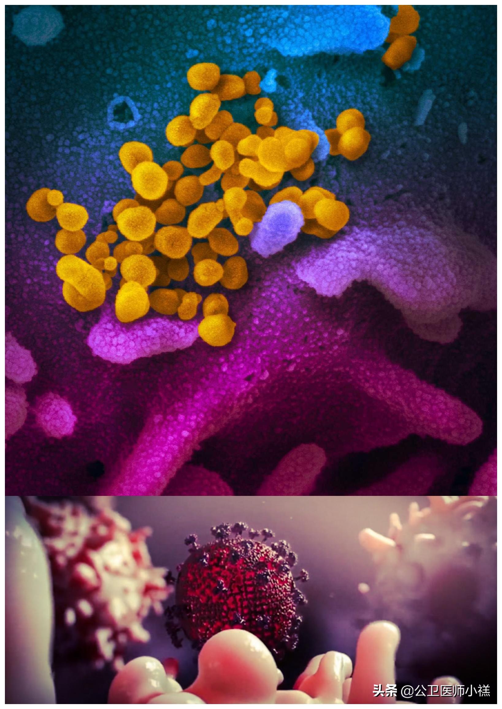 疫情期间怀疑自己有病了,疫情期间怀疑感染