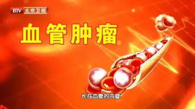 常见恶性肿瘤的警告信号,医生总结了恶性肿瘤的八个信号