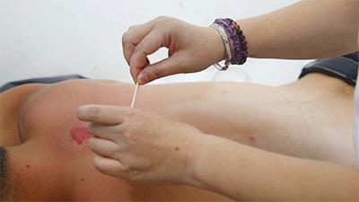 一看就会手把手教拔罐疗法,学拔罐视频教程全集