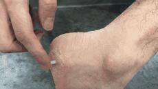 脚容易出汗怎么办？鞋臭怎么办？只需一招轻松搞定