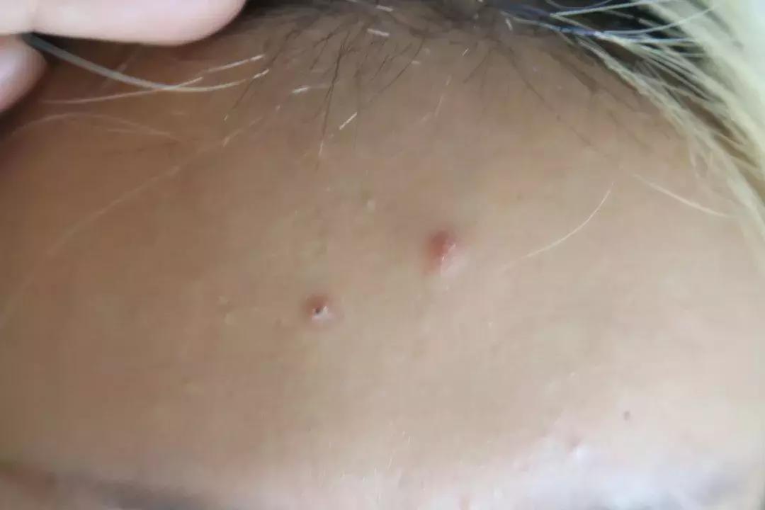 超级大黑眼圈眼袋怎么化妆遮盖,化妆遮黑眼圈眼袋种草产品