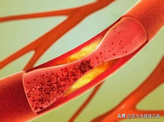 甲钴胺就是维生素b12吗,甲钴胺是维生素b12吗对胃好吗