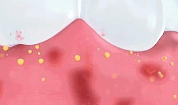 一张嘴就臭,一张嘴就口臭小妙招