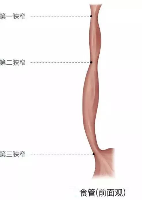 三个不良习惯容易得食管癌,年轻人担心得食管癌