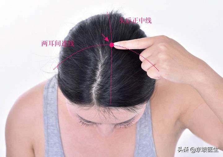 高血压眩晕可用哪一味中药,高血压眩晕针灸穴位