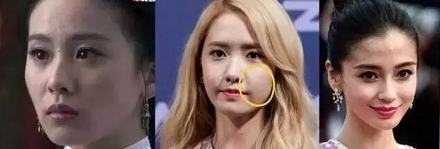 闭口反反复复长到底怎样才能根治,闭口反反复复长怎么办