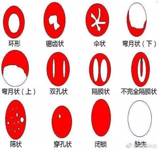 美*歌国**手每年带女儿检查处女膜是否完整,网友:?