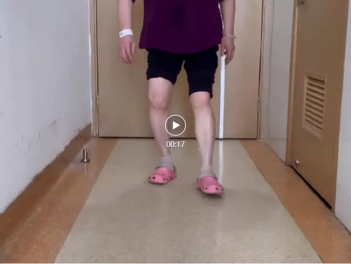 计算机导航下全膝关节置换,精确定位手术“生命线”