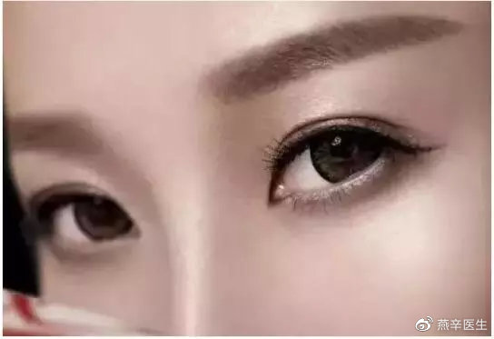 科普篇眼部整形的七大误区,关于眼整形这些事你一定要知道
