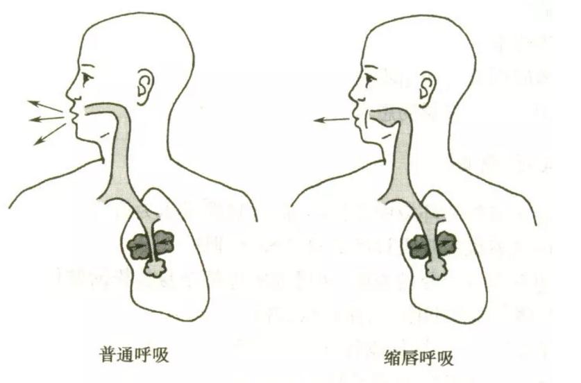 增强肺功能的呼吸体操,医生正确呼吸操