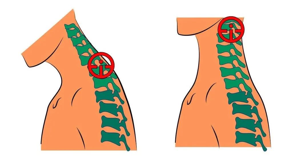 一上班就头痛休息就不会,每天上班觉得头疼头晕头重怎么办