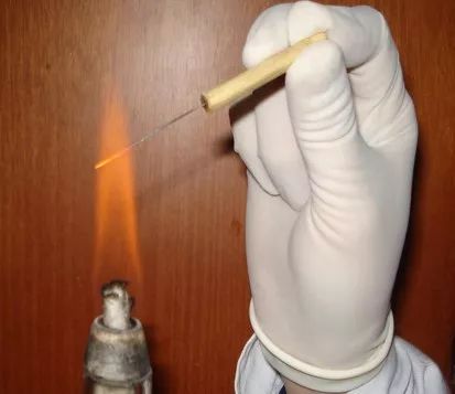 中医火针疗法教学视频,火针操作手法