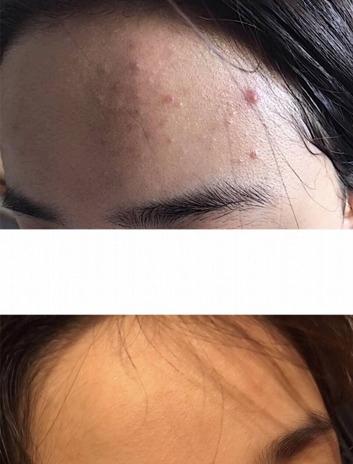 濂崇敓鐖嗙棙蹇呬拱娓呭崟鑽啅,鐖嗙棙浜у搧蹇呬拱娓呭崟