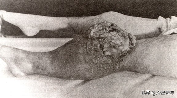 世界上第一个发现的元素,发现一种新的元素能获诺贝尔奖吗