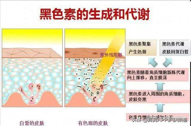 20岁女生可以祛斑吗,20岁的女生脸上有斑以及脸部暗淡