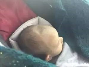 宝宝囟门之前是平滑现在凹陷,宝宝头顶的囟门宽正常吗