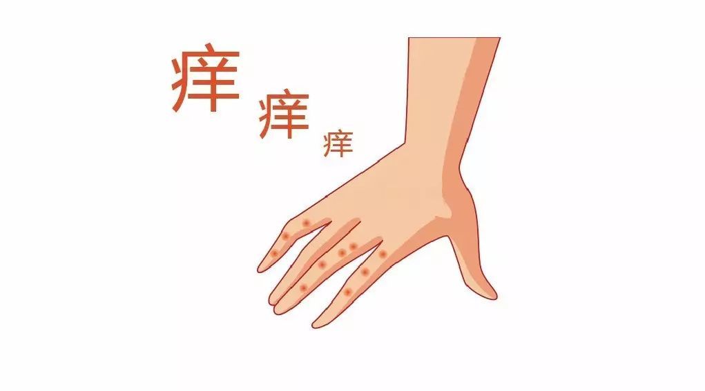 手上时不时起几个透明的小水泡,是大病的预兆吗?