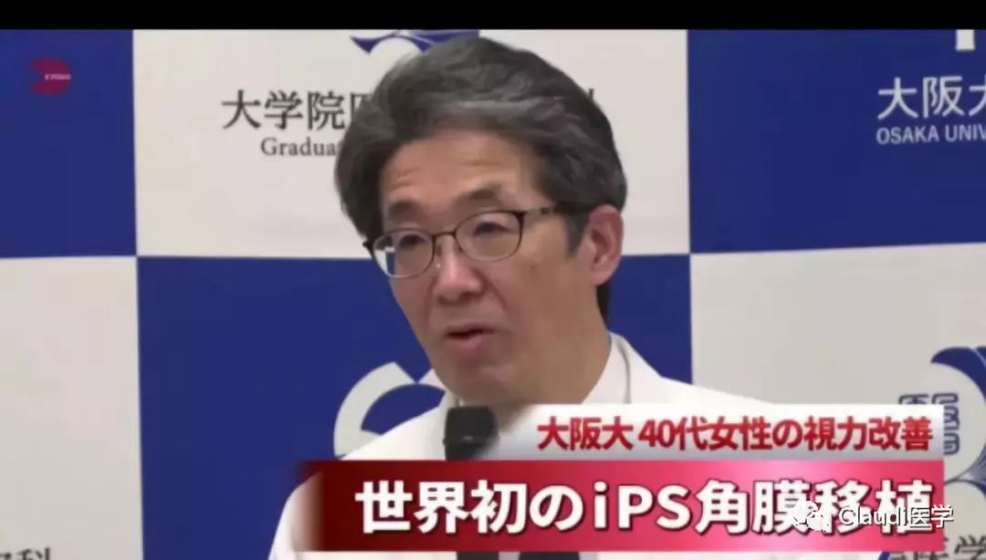 已成功两例!研究发现:移植正常眼部干细胞可治疗失明