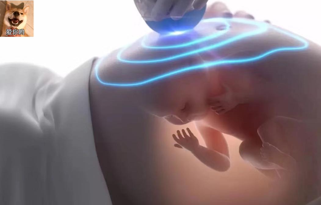 怀孕多久会有胎动胎动是什么感觉,怀孕后多久胎动频繁