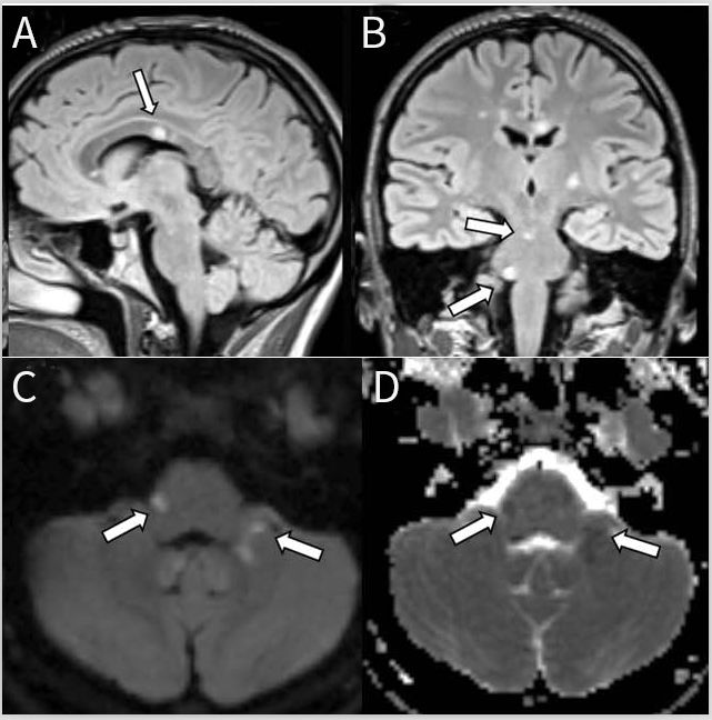 一文读懂13种最常见癌症筛查攻略,一文读懂5大慢性炎症检测项目