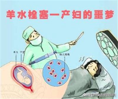 五种孕妇要当心羊水栓塞,什么产妇会出现羊水栓塞