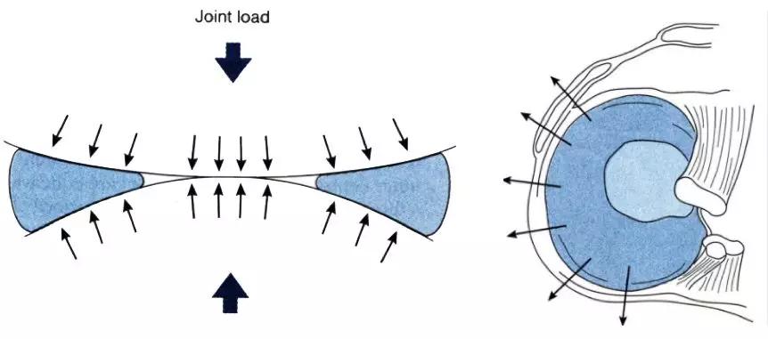 运动造成的半月板损伤的最好治疗,运动后半月板损伤怎么治疗