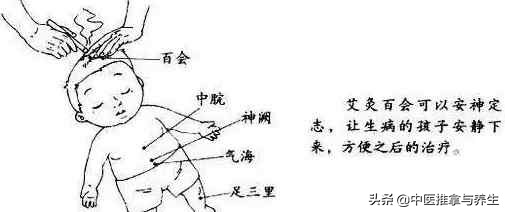小儿艾灸有效果,小儿艾灸肚脐的好处与功效