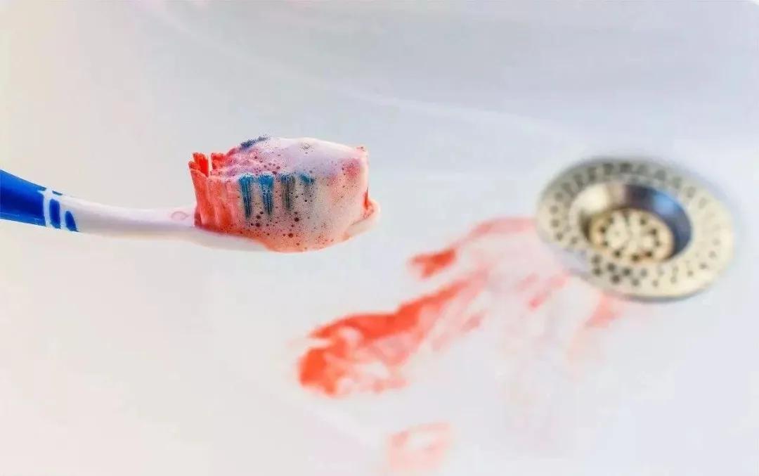 去除牙黄口臭牙膏实验,酵素牙膏去烟渍美白牙结石