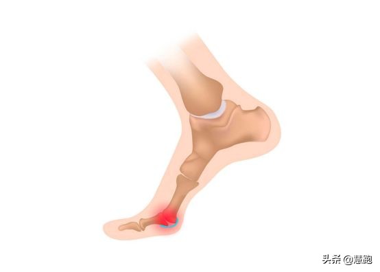 跑鞋如何挑选适合的码数,跑步买跑鞋要合脚还是要大一个码