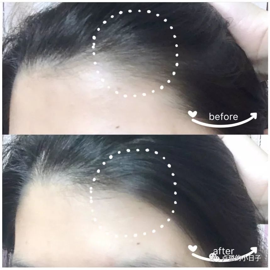 适合细软发质油头扁塌头的洗发水,适合油头细软塌发质防脱的洗发水