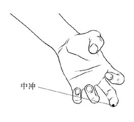 刺血疗法后的注意事项,刺血疗法注意事项及禁忌