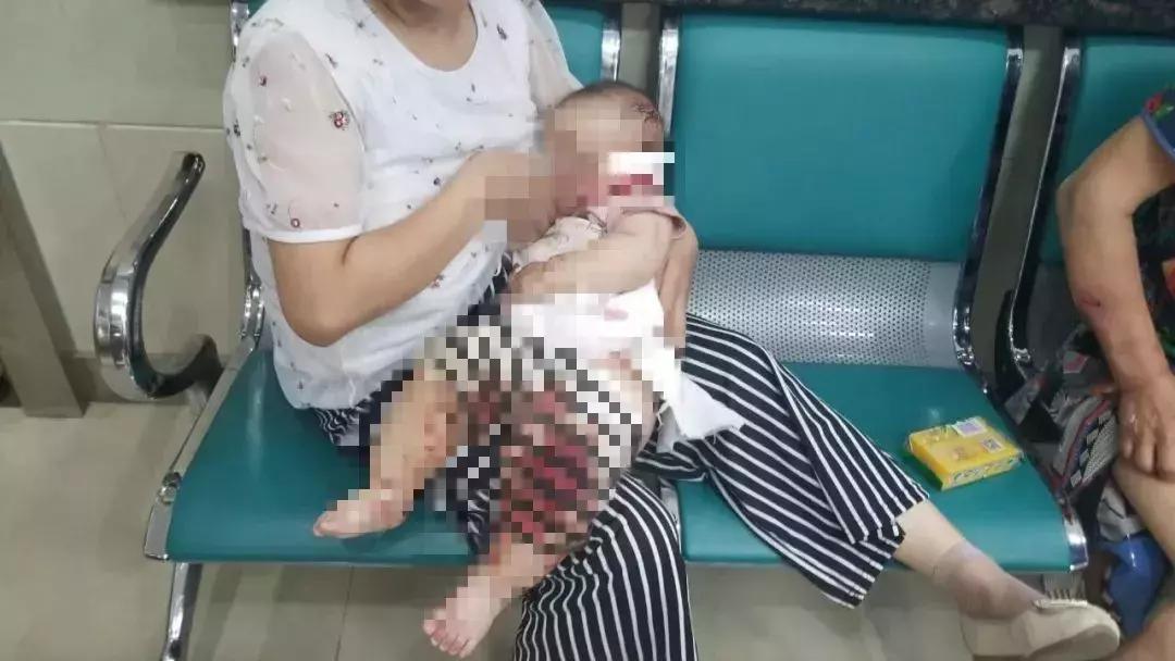 男子被一条狗疯咬,男子被狗追咬全身缝300多针