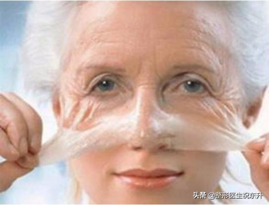 面部提升手术和拉皮手术是一样吗,面部小拉皮手术提升效果和视频