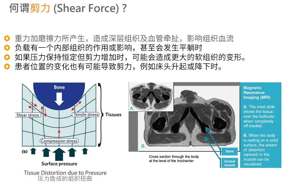 进口医用防褥疮气垫床推荐,气垫床老人防褥疮品牌推荐