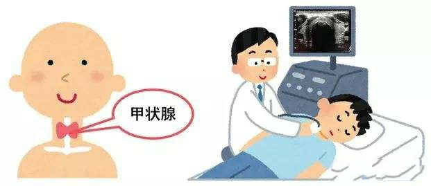甲状腺结节怎么办才能好得快,甲状腺结节医生建议做穿刺的原因