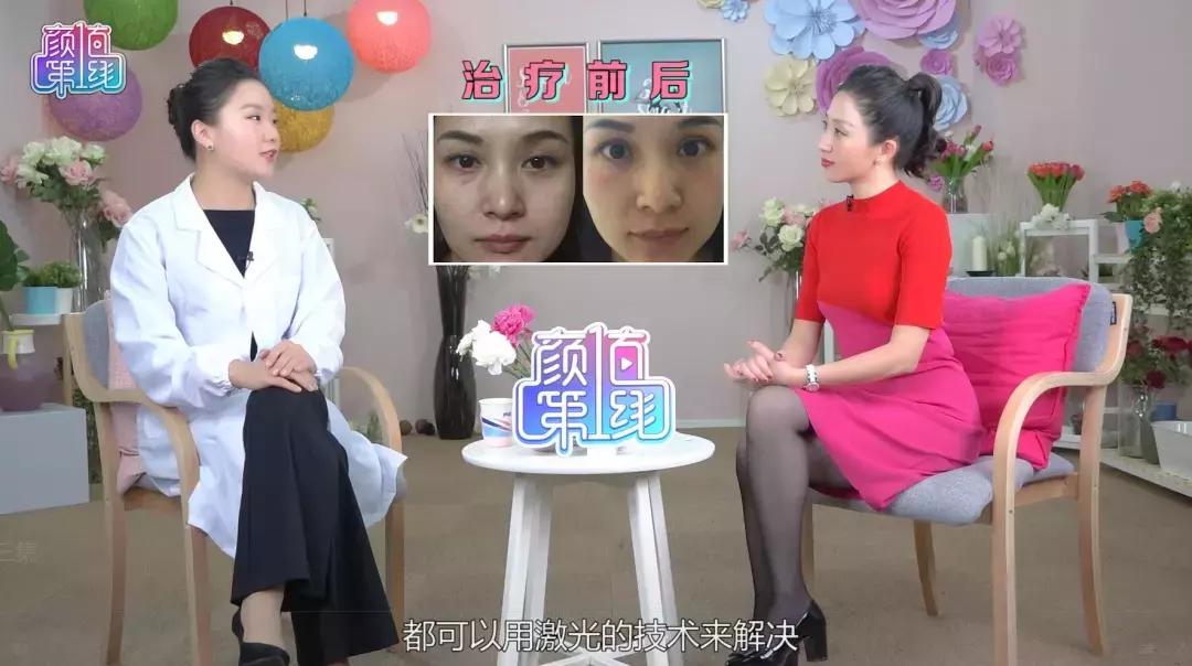 去眼袋15年后有细纹怎么办,祛眼袋之后会不会看着很平