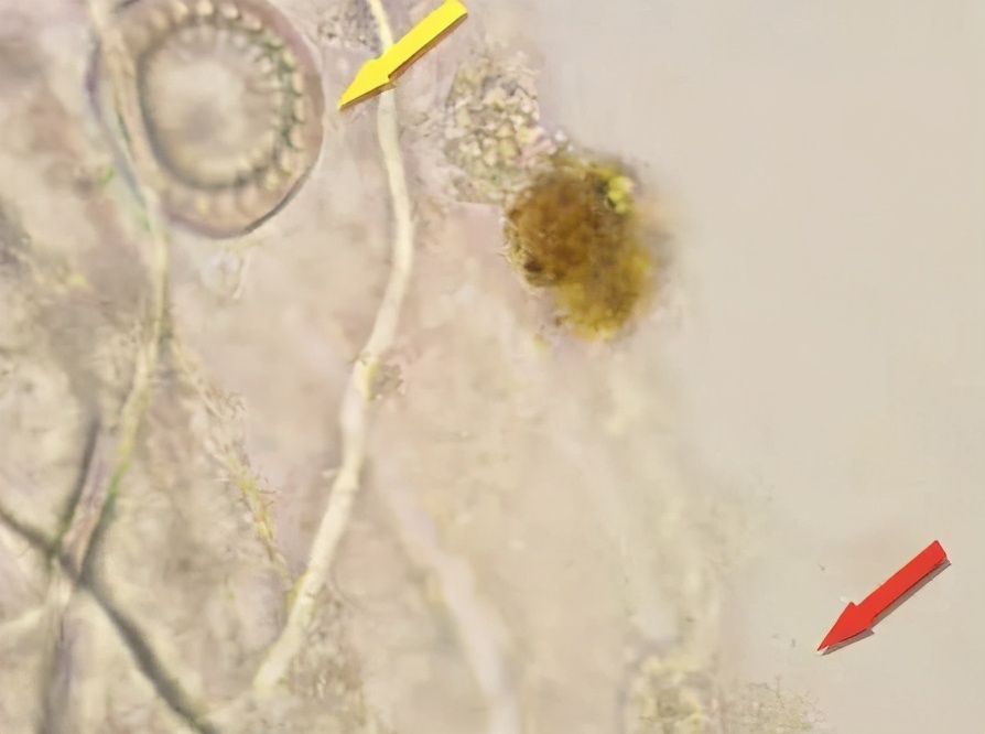 烂鳃的症状,烂鳃是什么菌引发