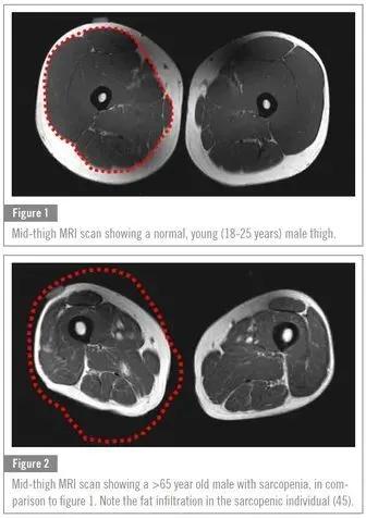 长期不吃肉身体会缺乏什么,长期吃肉突然吃素对身体有影响吗