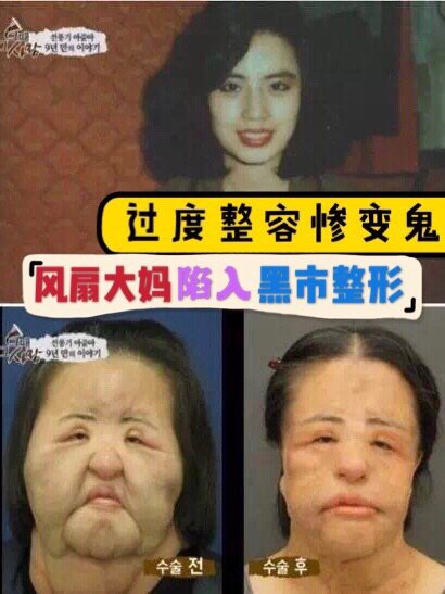 不用整形也可以变美吗,想变美做哪些手术