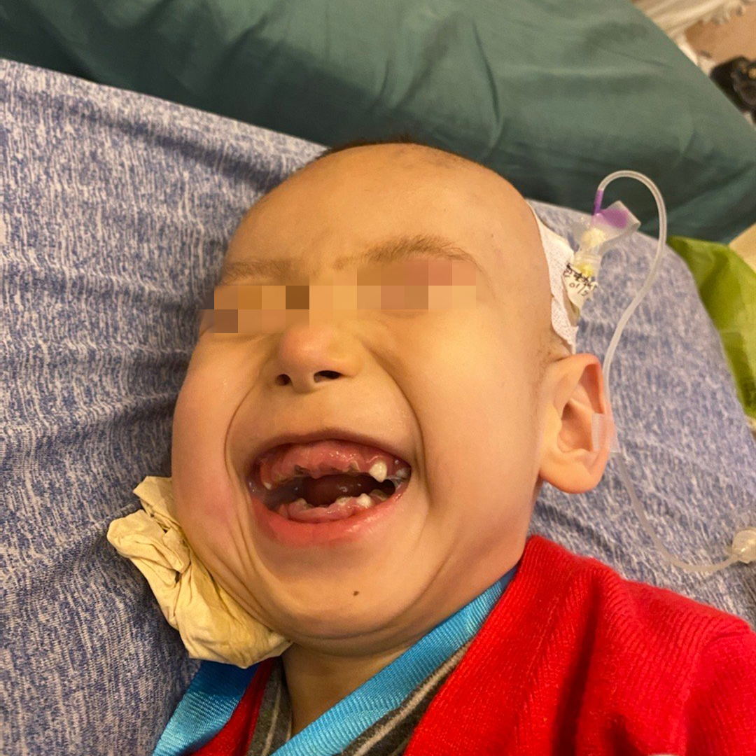 罕见病父亲自研药救孩子,孩子罕见病父亲为其制作药物