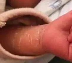 新妈妈别再乱担心了,月嫂总结宝宝的这28种情况是正常的