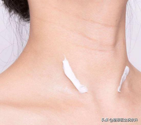 你的皱纹是怎样的,你的颈纹是这样的吗