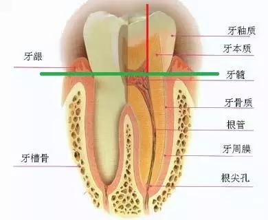 美容冠是指的什么,美容冠到底是什么