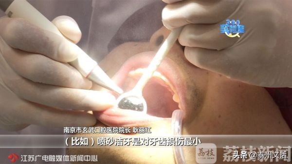 超强美白牙贴,网红美白牙笔有没有用