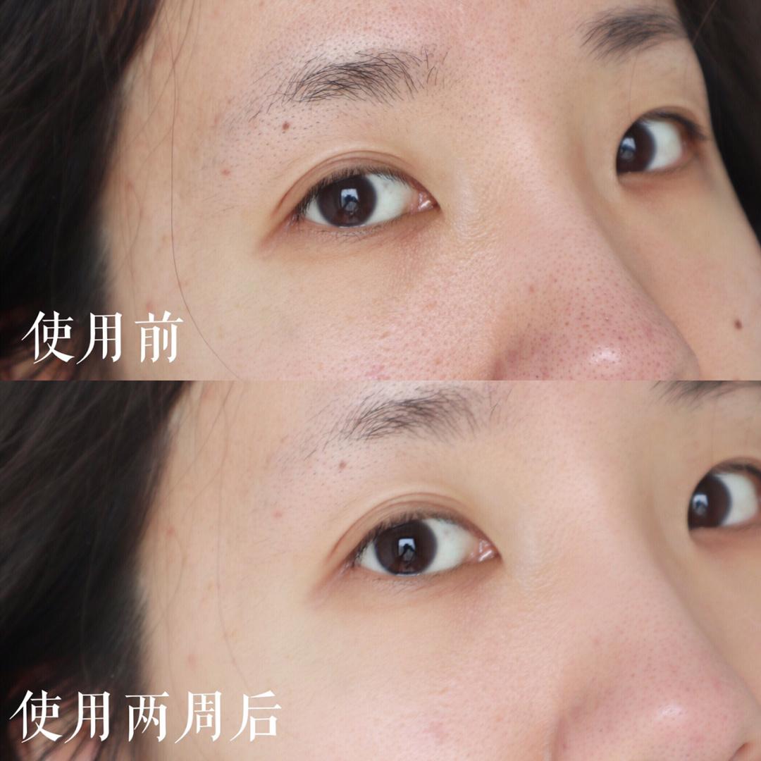 实惠的熬夜护肤必备品,口碑最好的熬夜护肤品套装