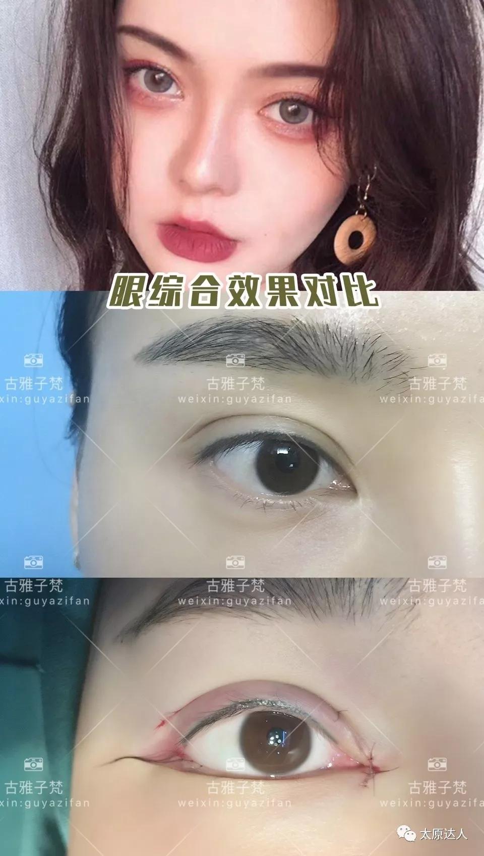 814元人气精华护理免费做！一次就焕颜新生！聚会女王就是你