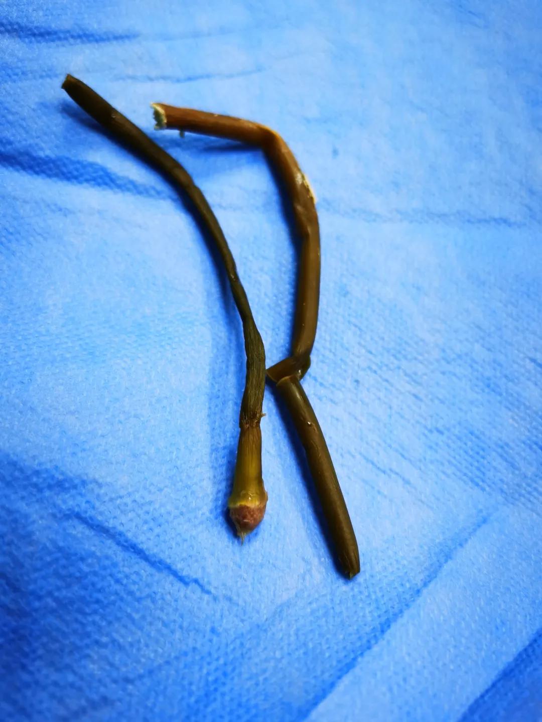 这一老一少为寻求刺激,对自己私密部位做了这事!结果双双进了医院……