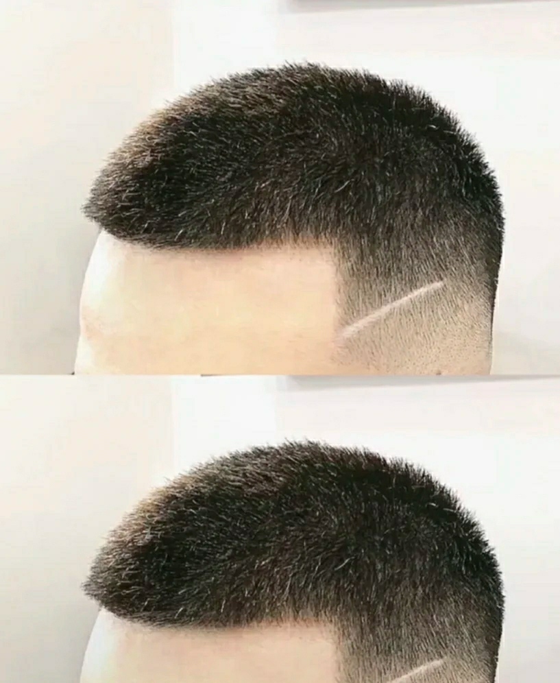 男生头发两边特别炸什么原因,男生头发粗硬鬓角会炸