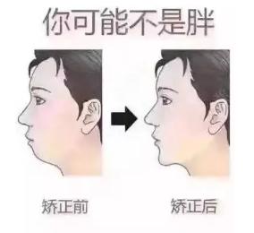 十个牙齿矫正的误区,矫正牙齿的十个误区