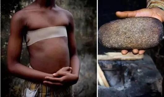熨平少女胸部!揭秘非洲可怕习俗“烫乳”